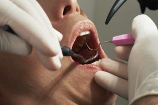 dentist working on a mouth